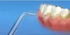 Waterpik Jt 100 Jet Tips Aufsatz für Wasserflosser 2 Stück Produktbild-Vorschau 3