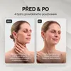 GESS Exotic – Ultrazvukový peeling obličeje 7v1: Náhled obrázku produktu 13