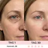LED-oogmasker met roodlicht- en microstroomtherapie – Productafbeelding-voorbeeld 3