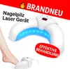 Laserové zariadenie na liečbu plesní nechtov Liečba plesní Náhľad obrázku produktu 1