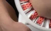 TESMED CELLULITE – Manuelles 3-in-1 Anti-Cellulite Produktbild-Vorschau 12