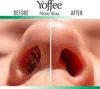 Kit originale Yoffee Nose Wax - Set per la depilazione - Anteprima dell’immagine prodotto 5