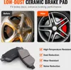 SucceBuy set di freni anteriori per Vauxhall Adam (M13), Anteprima dell’immagine prodotto 3