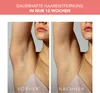 FOREO PEACH 2 IPL-Haarpflegegerät für glatte Haut – Sanfte Produktbild-Vorschau 5