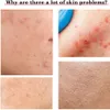 Multifonctionnel visage soins de la peau Massager Voir les images du produit 9