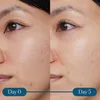 Sérum Super-C Dynamic Resurfacing d'ELEMIS, 30 ml Voir les images du produit 4
