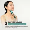 Odstraňovač černých teček Blackhead Vacuum Remover GESS Náhled obrázku produktu 4