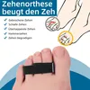 10 Stück Trigger Finger Schiene, Verstellbare Atmungsaktiv Produktbild-Vorschau 5