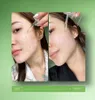 ANUA Azelaic Acid 10 Hyaluron Redness Soothing Serum Náhľad obrázku produktu 2
