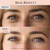 A split image showing a woman's eyes before and after using an eye serum. The top image shows wrinkles, and the bottom image shows a reduction in wrinkles after 6 weeks. Voir les images du produit