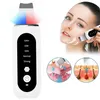 Appareil de gommage à ultrasons Nettoyeur de pores visage Voir les images du produit 3