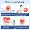 Mandelstein Entferner, Tonsillenstein Entferner​, 3 Produktbild-Vorschau 7