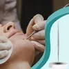 Łyżeczki do Usuwania Wągrów Zestaw Wyciskania Zaskórników 7 Podgląd zdjęcia produktu 5