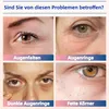 GlowPads Pro™ Augenpads Augenmassagegerät bei Augenringe, Produktbild-Vorschau 3