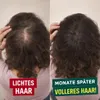 GrowMax™ LED Laser Cap Haarkappe - Förderung Haarwuchs & Produktbild-Vorschau 4
