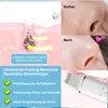 OKWISH Elektrický čistič pórů, odstraňovač černých teček, Náhled obrázku produktu 4