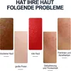 Gesichtsroller Eishammer ICY Gesichtsmassagegerät zur Produktbild-Vorschau 7