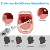 Mandelstein Entferner, 3 Geschwindigkeiten, LED Licht, 5 Produktbild-Vorschau 5