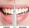 AILORIA Schall-Zahnreiniger DEPLAQUED Produktbild-Vorschau 5