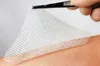 Lomatuell H 5x5cm, 10 St. Verband Produktbild-Vorschau 12