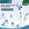 Porenreiniger für das Gesicht, Mitesserentferner mit Produktbild-Vorschau 4