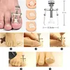 Eingewachsene Zehennägel Set, Professionelle Nagelpflege Produktbild-Vorschau 5
