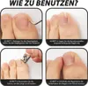 60 Stück Eingewachsene Zehennägel Set, Zehennagelkorrektur Produktbild-Vorschau 5