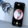 Visueller Ohrreiniger, digitales 1080P-HD-Otoskop, Produktbild-Vorschau 7