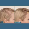 ShinyHair Haarwuchsbooster - Nahrungsergänzungsmittel gegen Produktbild-Vorschau 3