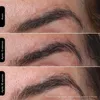 Silk'n FLM100PE1001, Lichttherapie der Haut, Weiß, Produktbild-Vorschau 9