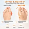 Zehen Korrektur Tape gegen Hallux Valgus, medizinischer Produktbild-Vorschau 2