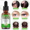 Rosmarinöl Ätherisches Öl gesunde Kopfhaut Haarwachstum Produktbild-Vorschau 6