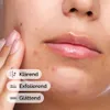 The Ordinary Salicylzuur 2% Oplossing Productafbeelding-voorbeeld 4