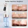 Porenreiniger Electric Mitesserentferner, Vakuum Cleaner 6 Produktbild-Vorschau 3