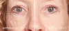 My Perfect Eyes – Augencreme – 10 g Produktbild-Vorschau 14