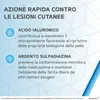 SOFARGEN Gel mit Hyaluronsäure und Silber-Sulfadiazin, Produktbild-Vorschau 3