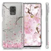kwmobile hoesje, compatibel met Xiaomi Redmi Note 9S / 9 Productafbeelding-voorbeeld 5
