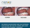 Remos Zahnradierer Zahnverfärbungsradierer 5 cm Produktbild-Vorschau 4