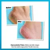 O Keeffe s Healthy Feet Krem do Stopi Ekstremownie Suche i Podgląd zdjęcia produktu 3