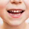Close-up of a child's mouth showing teeth and gums. Produktbild-Vorschau