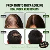 2stk Haarwachstumsspray, 50 ml, natürlicher, Produktbild-Vorschau 13
