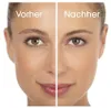 VITALMAXX Perfect Shave 2048: Trimmer/Scheerapparaat, werkt Productafbeelding-voorbeeld 4