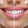 CorpCare Miracle Smile - Reinigungsaufsätze 2tlg für Produktbild-Vorschau 5