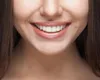 Curaprox Perio Plus Suport Zahnpasta mit +0,09 CHX Produktbild-Vorschau 16