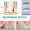 Urządzenie do terapii światłem South Moon Nail Fungus Lampa Podgląd zdjęcia produktu 8