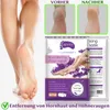 Masque pour les pieds Exfoliant pour les pieds Soin des Voir les images du produit 7