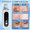 Appareil de gommage à ultrasons Nettoyeur de pores visage Voir les images du produit 16