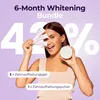 Sada pro bělení zubů OnlySmile – balení na 6 měsíců: 3x Náhled obrázku produktu 2