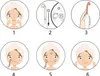 Darsonval Derma Wand Pro Gesichtspflegegerät 4 Elektroden Produktbild-Vorschau 10
