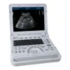 Échographe portable avec sonde linéaire Doppler couleur Voir les images du produit 8
